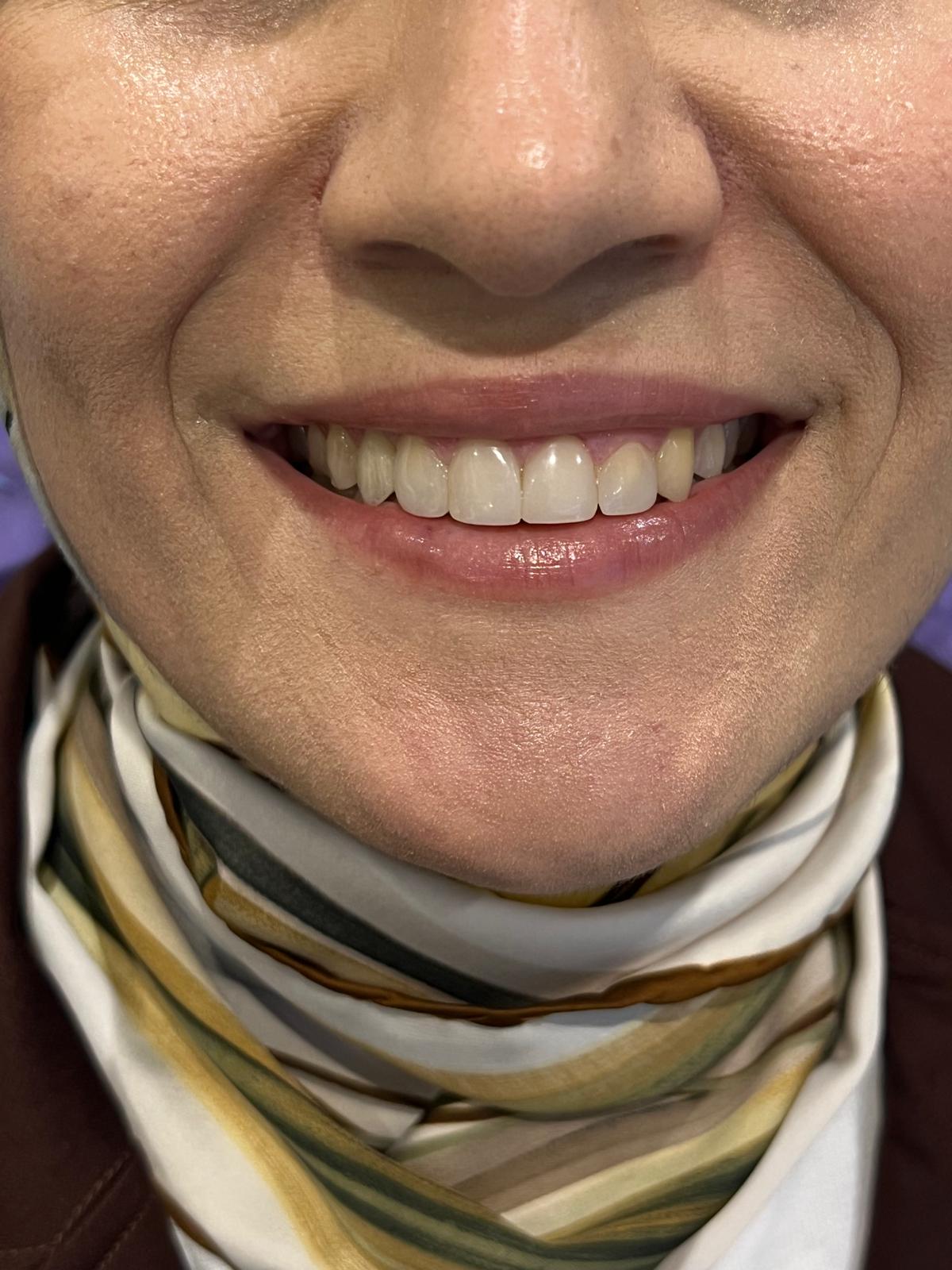 ECE Dental Patient Transformation